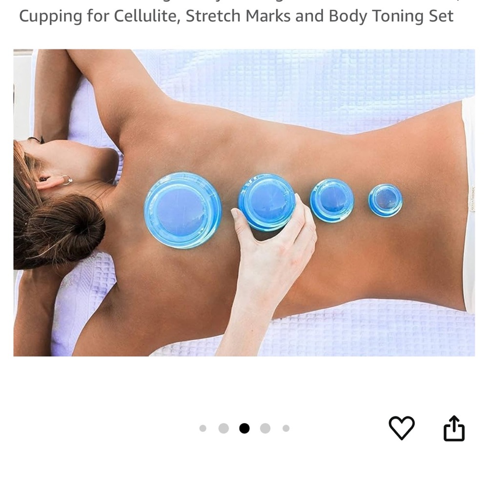 Cupping Cups - Picture 4 of 4